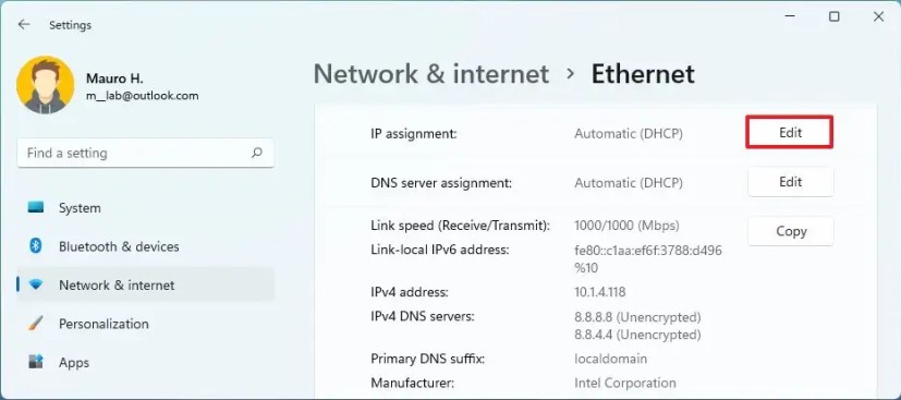 Rediger TCP/IP Ethernet-innstillinger