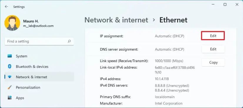 Redigera TCP/IP Ethernet-inställningar